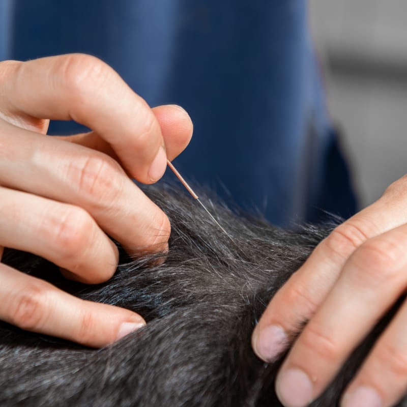 Acupuncture, Nashua